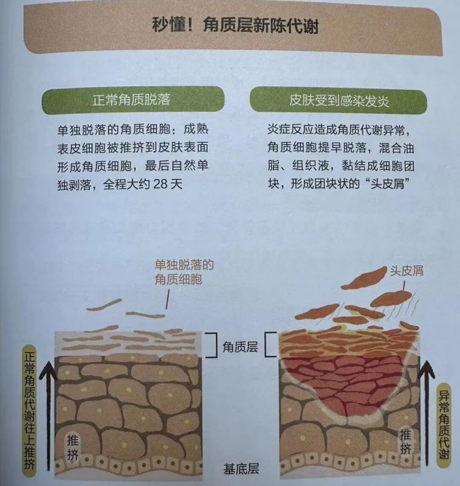 洗发的真相:从超市随便买到认真做研究