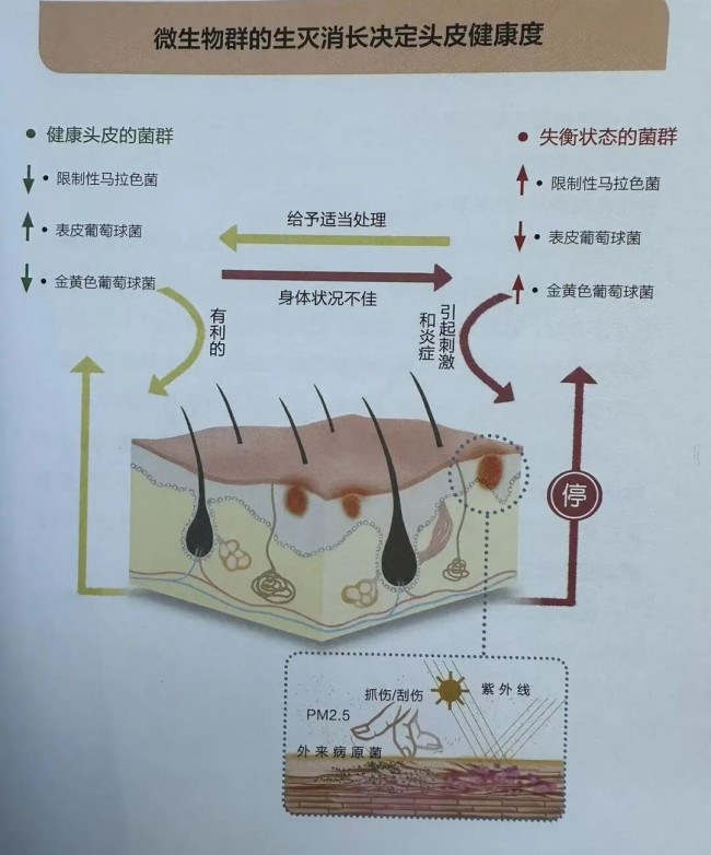 洗发的真相:从超市随便买到认真做研究